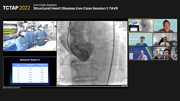 Structural Heart Disease Live Case Session 1: TAVR