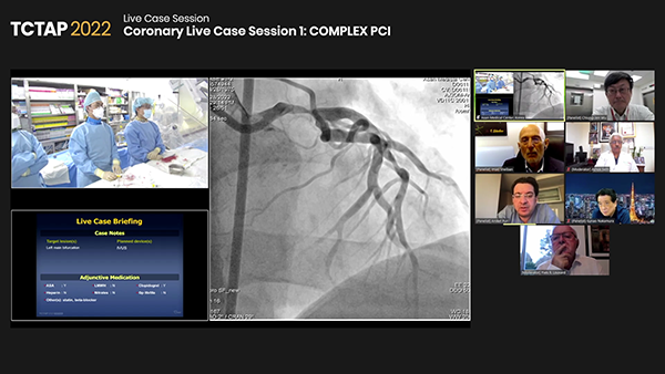 Coronary Live Case Session 1: COMPLEX PCI
