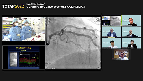 Coronary Live Case Session 2: COMPLEX PCI