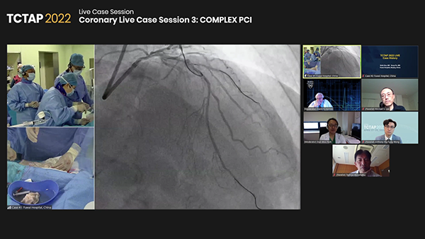 Coronary Live Case Session 3: COMPLEX PCI