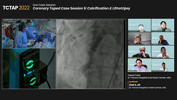 Coronary Taped Case Session 5: Calcification & Lithotripsy