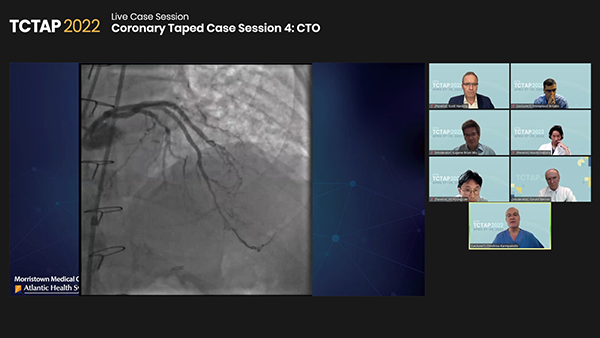 Coronary Taped Case Session 4: CTO	