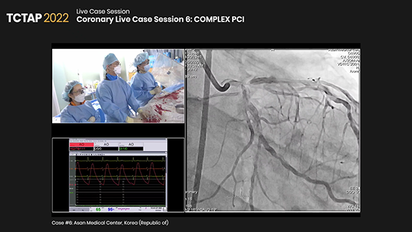 Coronary Live Case Session 6: COMPLEX PCI