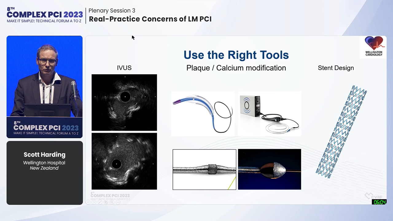 Plenary Session 3: Real-Practice Concerns of LM PCI