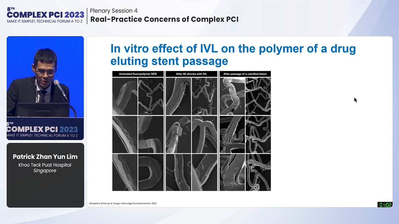 Plenary Session 4: Real-Practice Concerns of Complex PCI