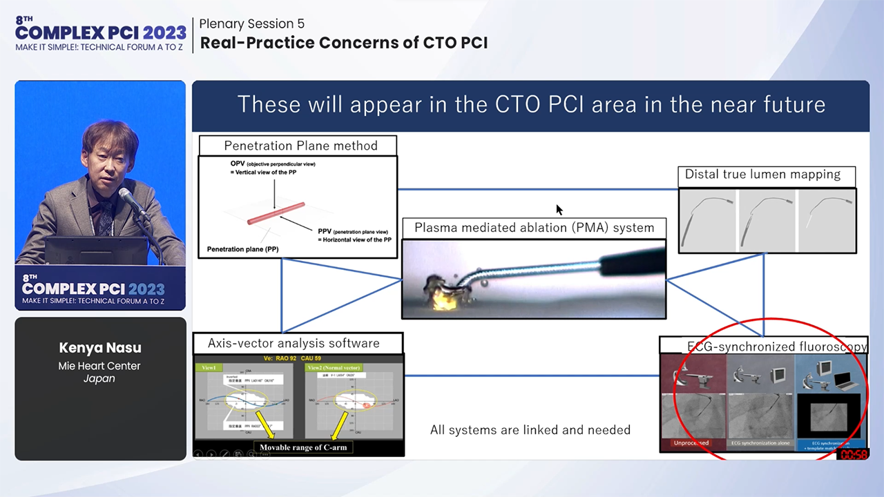 Plenary Session 5: Real-Practice Concerns of CTO PCI