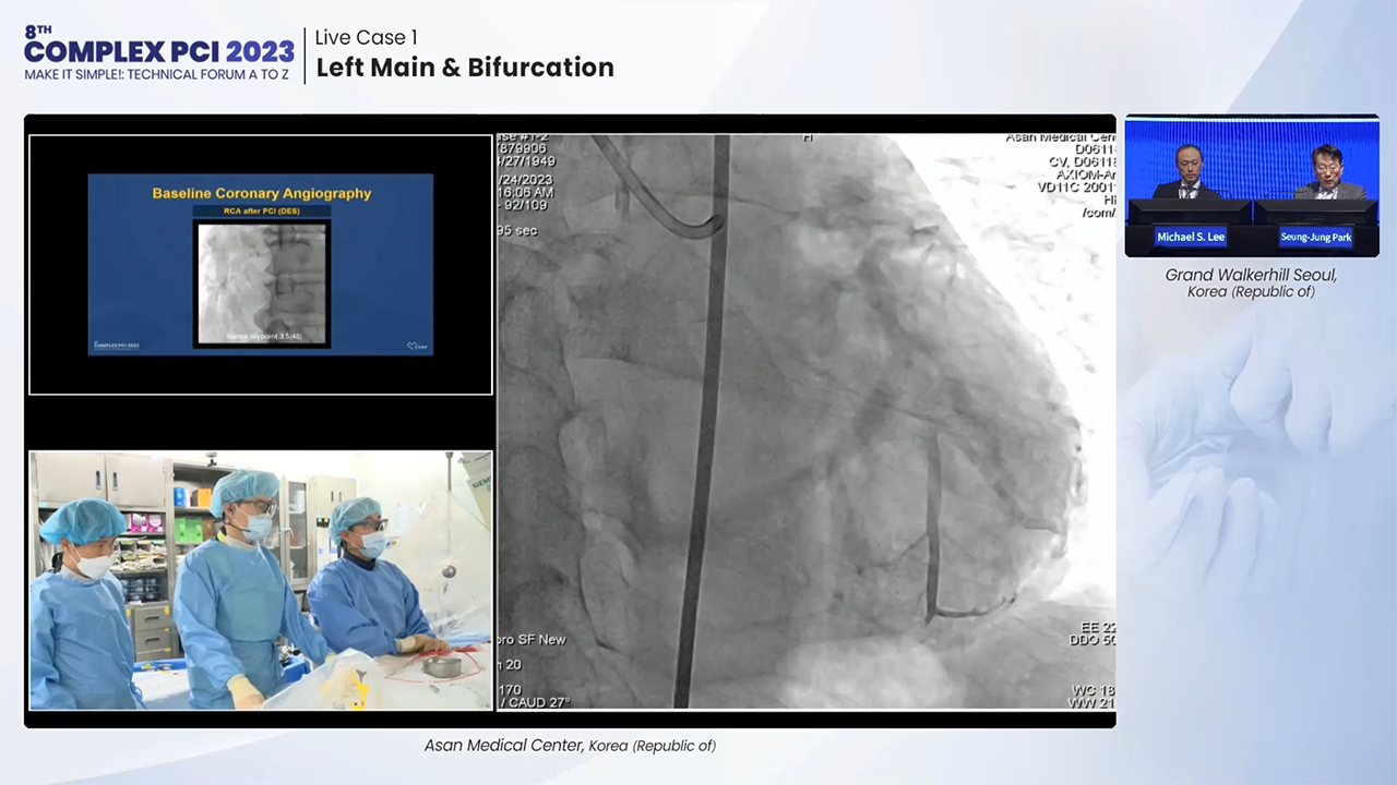 Live Case 1: Left Main & Bifurcation