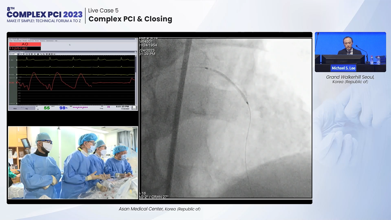 Live Case 5: Complex PCI & Closing