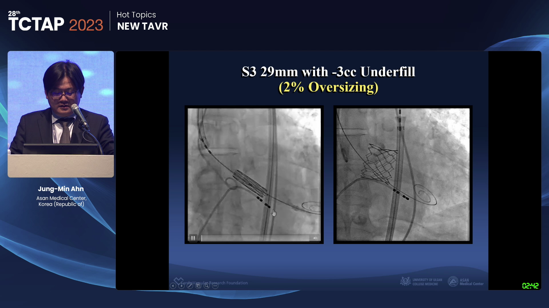 [Hot Topics] NEW TAVR