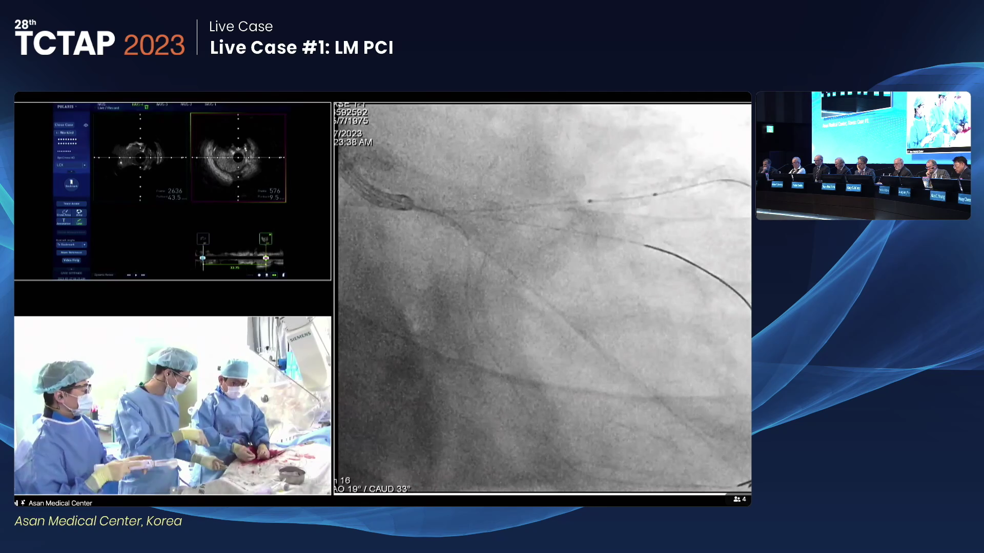 Live Case #1: LM PCI