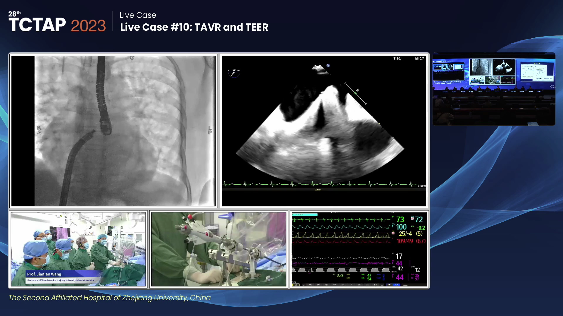 Live Case #10: TAVR and TEER