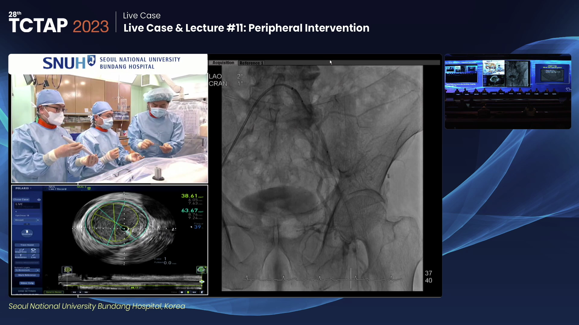 Live Case & Lecture #11: Peripheral Intervention