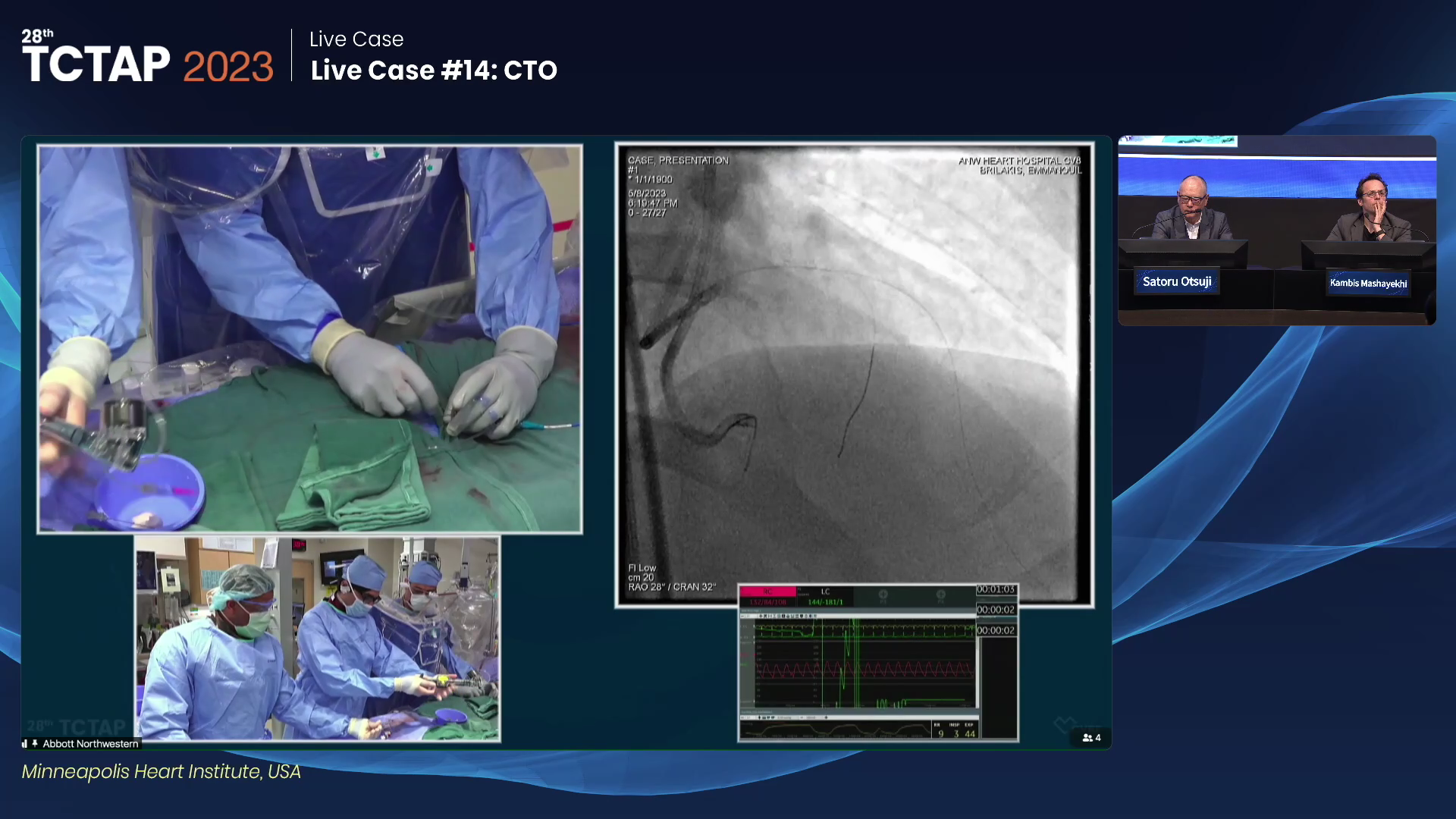 Live Case #14: CTO