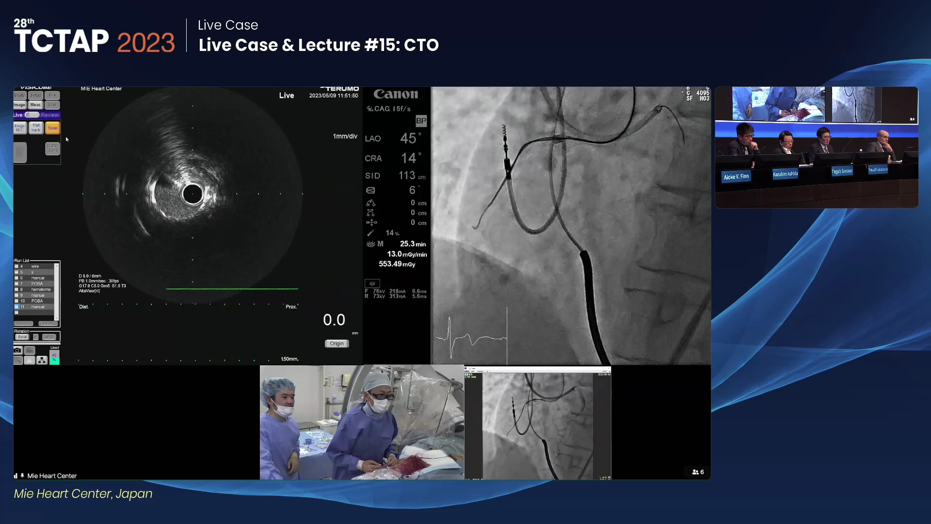 Live Case & Lecture #15: CTO