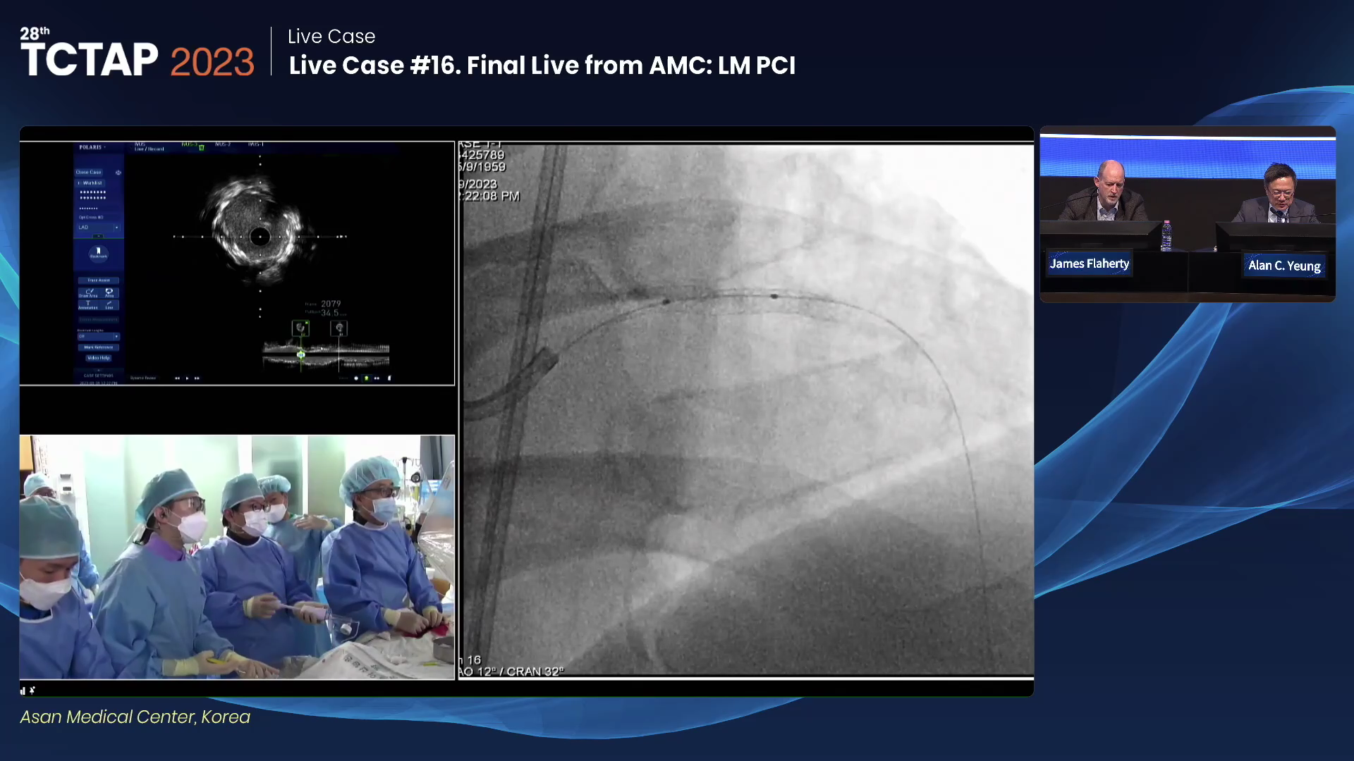 Live Case #16. Final Live from AMC: LM PCI