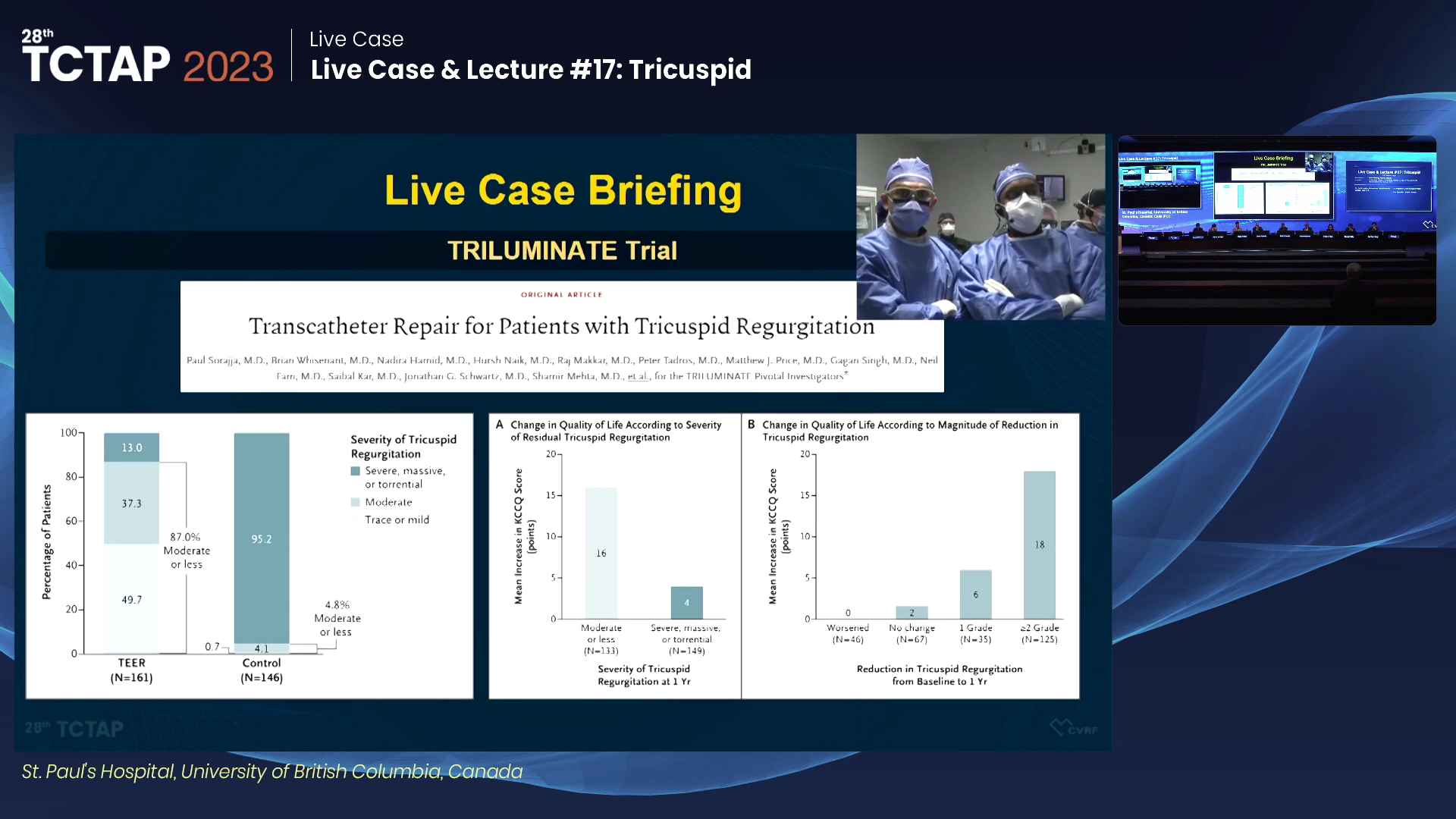 Live Case & Lecture #17: Tricuspid