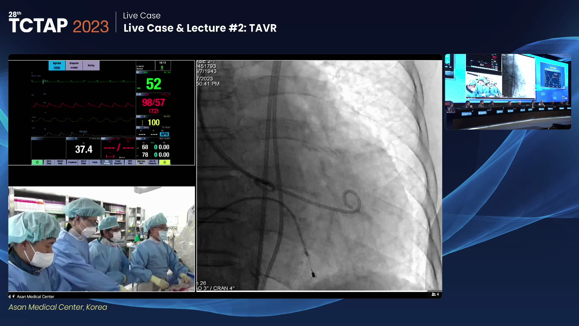 Live Case & Lecture #2: TAVR