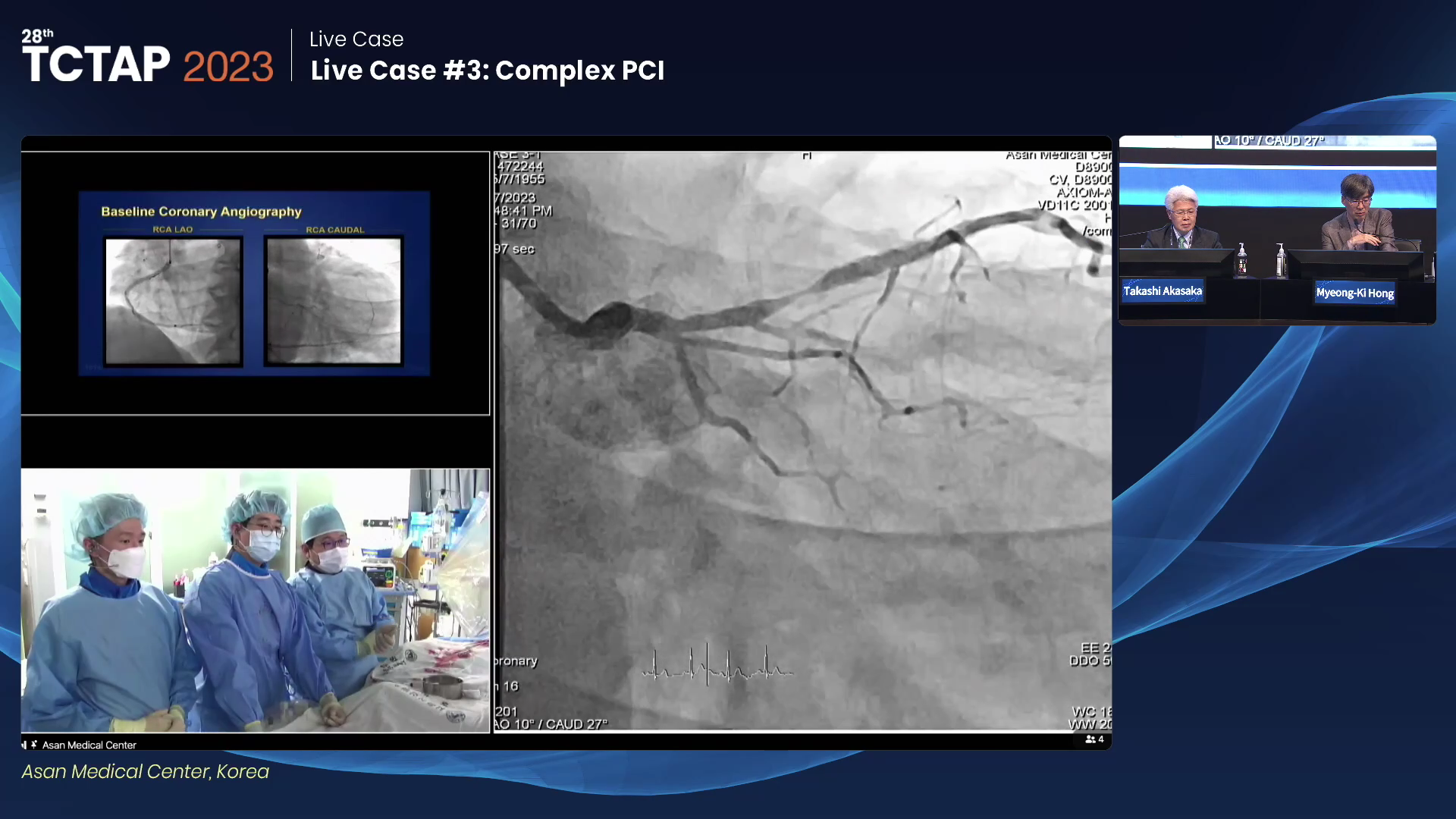 Live Case #3: Complex PCI