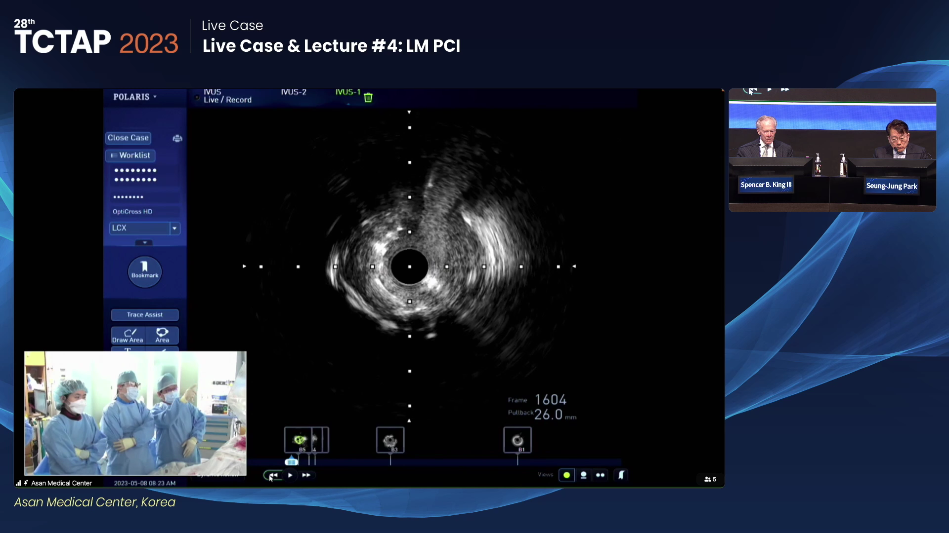 Live Case & Lecture #4: LM PCI