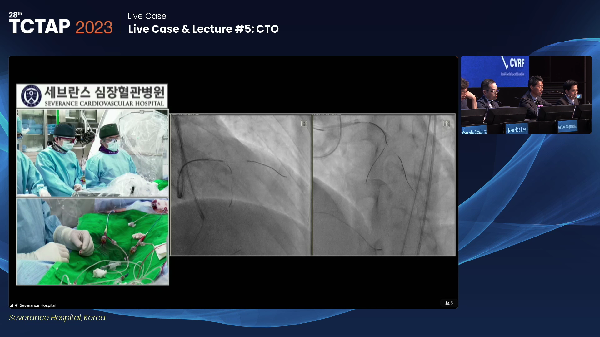 Live Case & Lecture #5: CTO