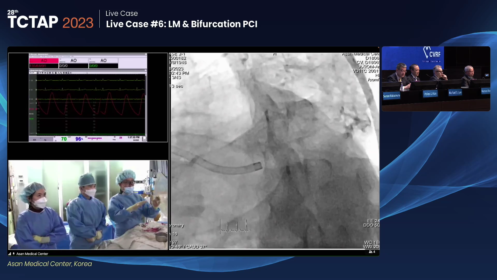 Live Case #6: LM & Bifurcation PCI