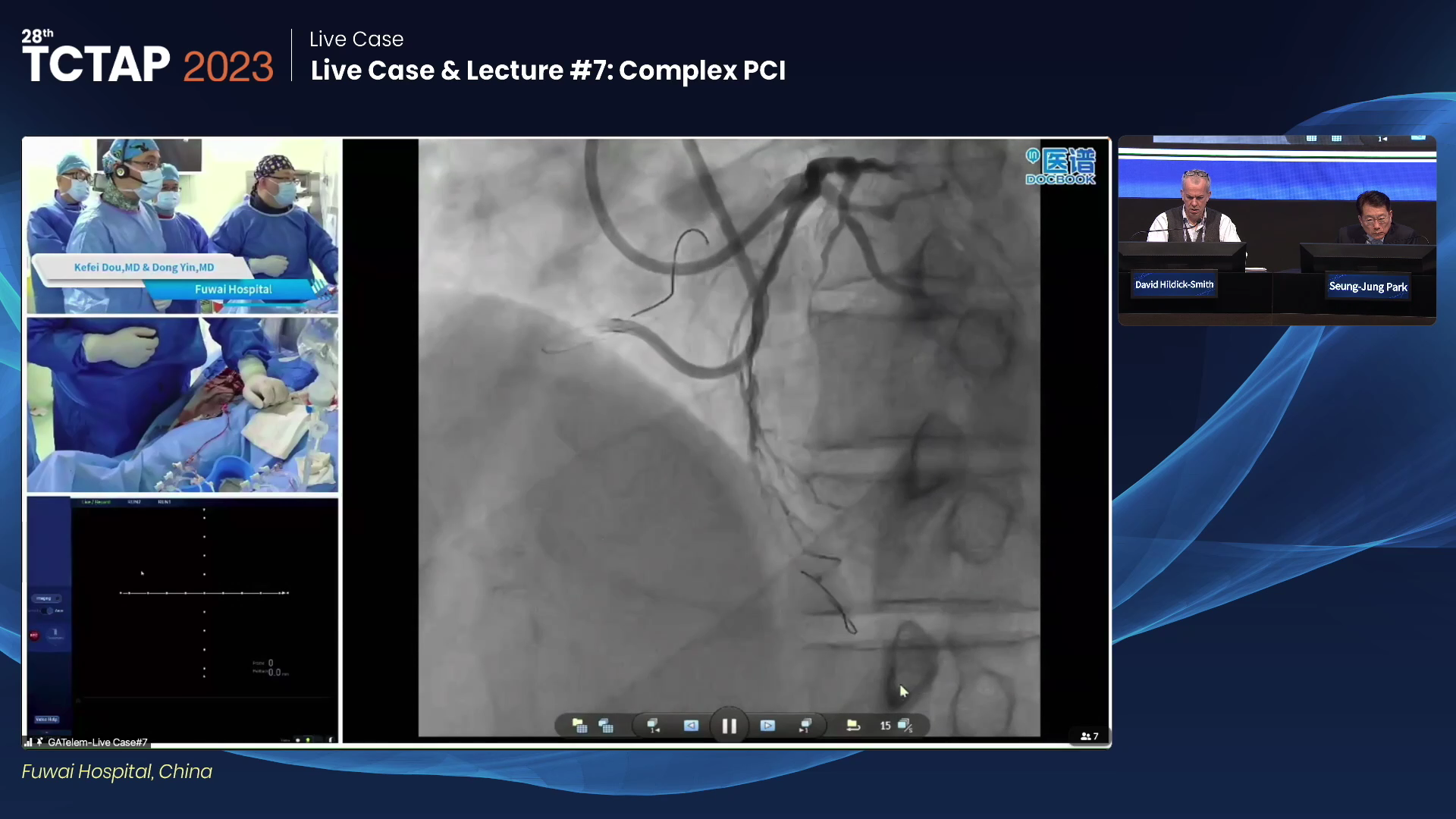 Live Case & Lecture #7: Complex PCI