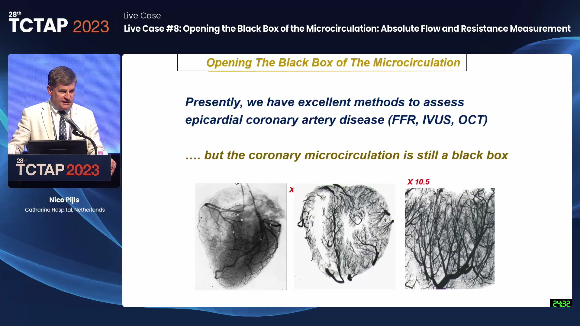 Live Case #8: Opening the Black Box of the Microcirculation: Absolute Flow and Resistance Measurement