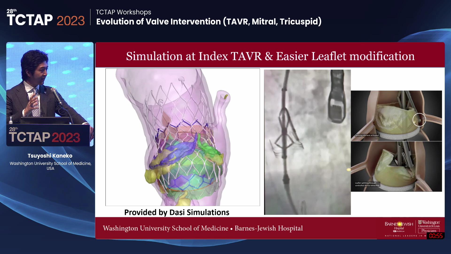 [TCTAP Workshops] Evolution of Valve Intervention (TAVR, Mitral, Tricuspid)