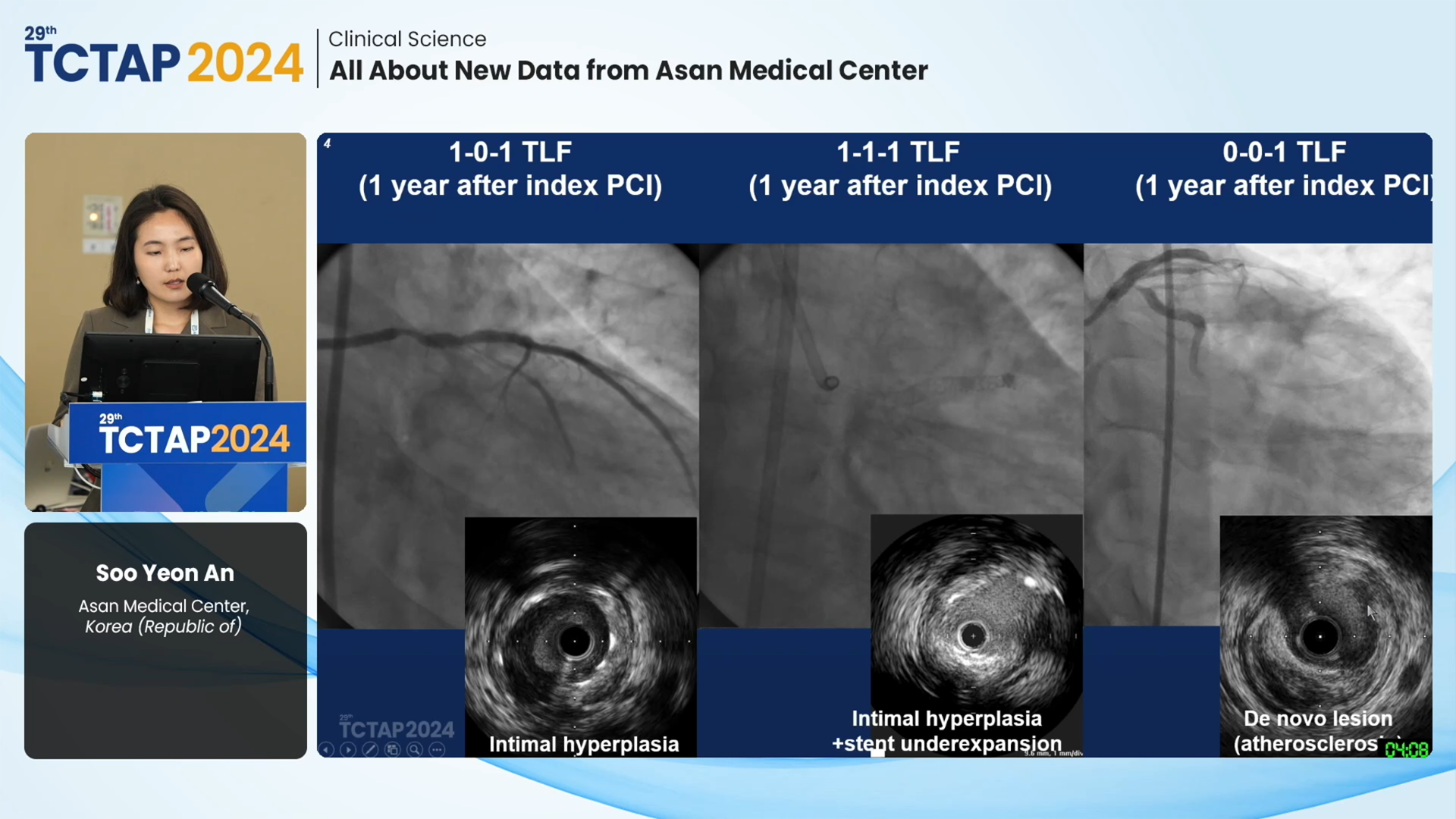 COMPLEX PCI 2021 Virtual