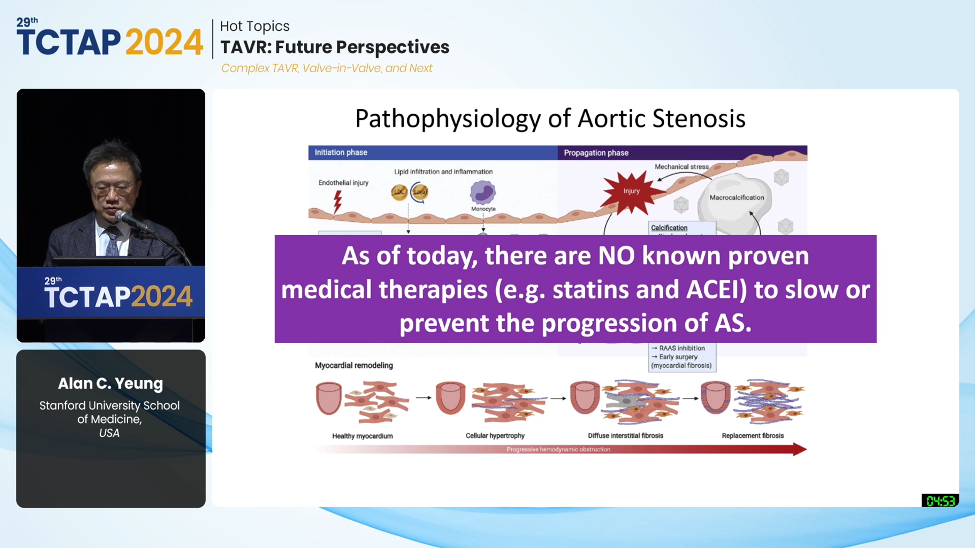 [Hot Topics] TAVR: Future Perspectives