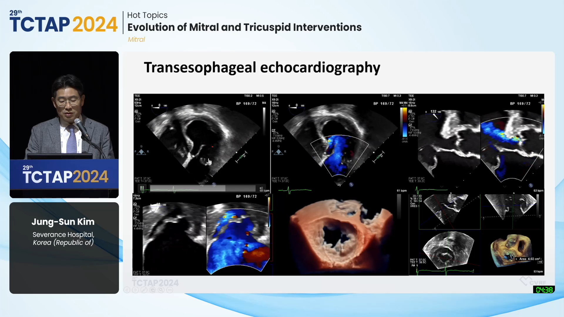 [Hot Topics] Evolution of Mitral and Tricuspid Interventions