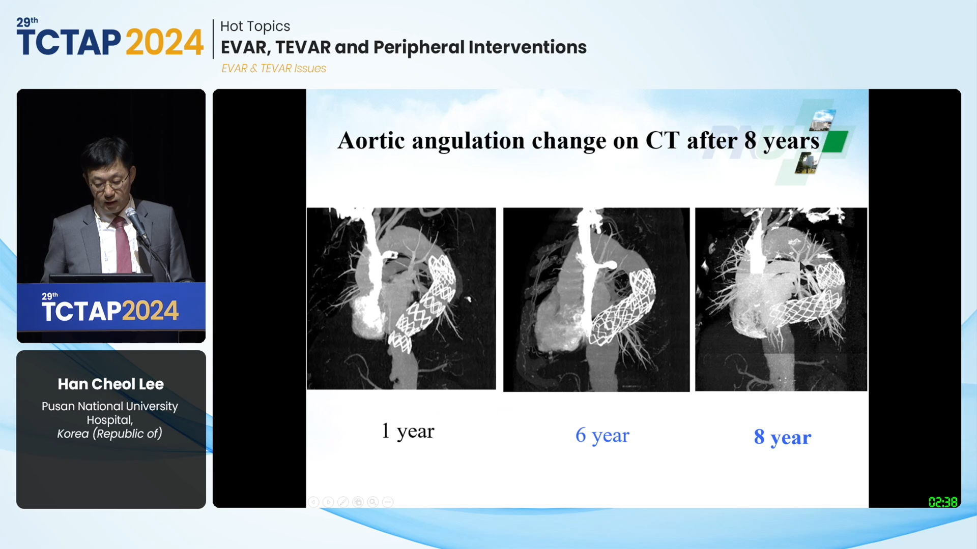 [Hot Topics] EVAR, TEVAR and Peripheral Interventions