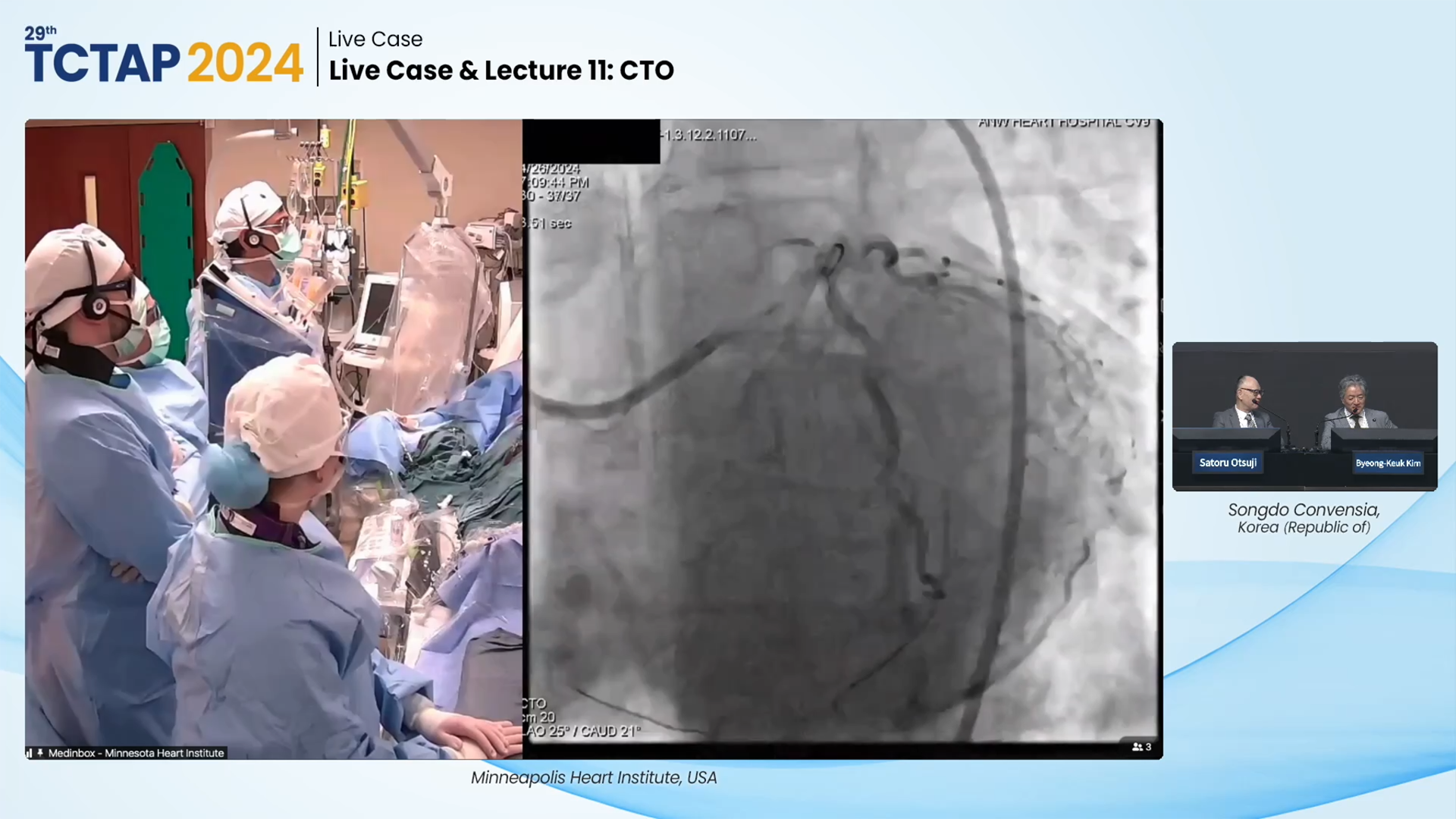 Live Case & Lecture 11: CTO