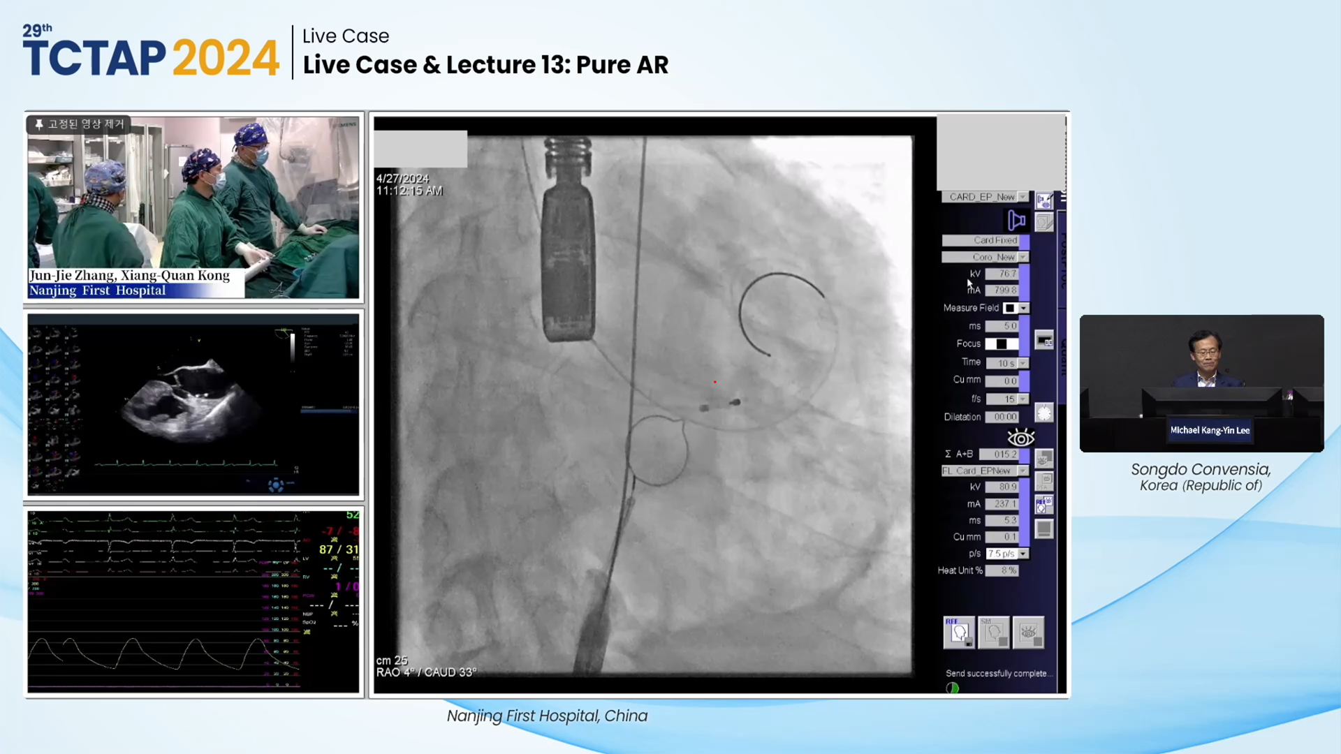 Live Case & Lecture 13: Pure AR