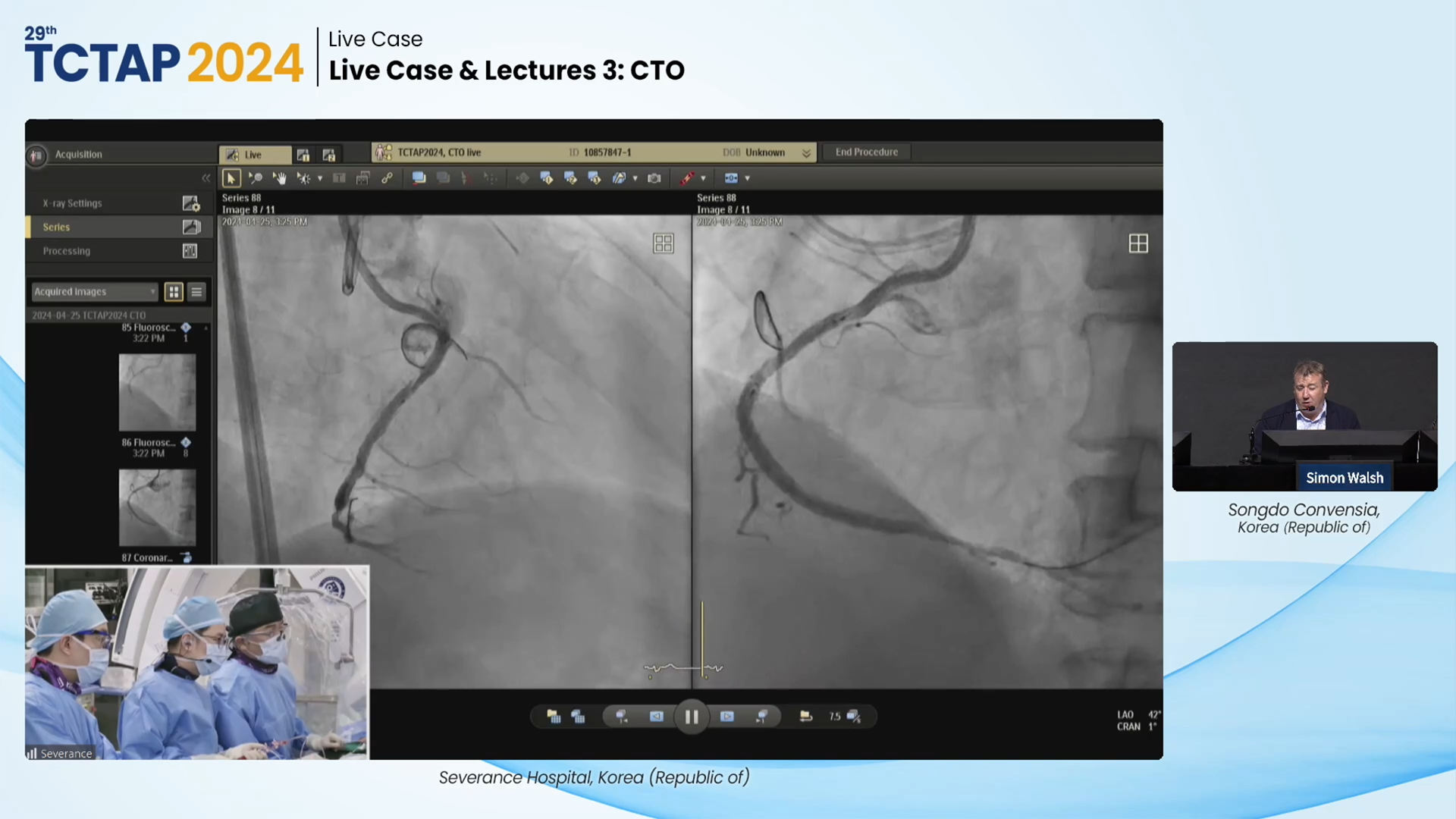 Live Case & Lectures 3: CTO