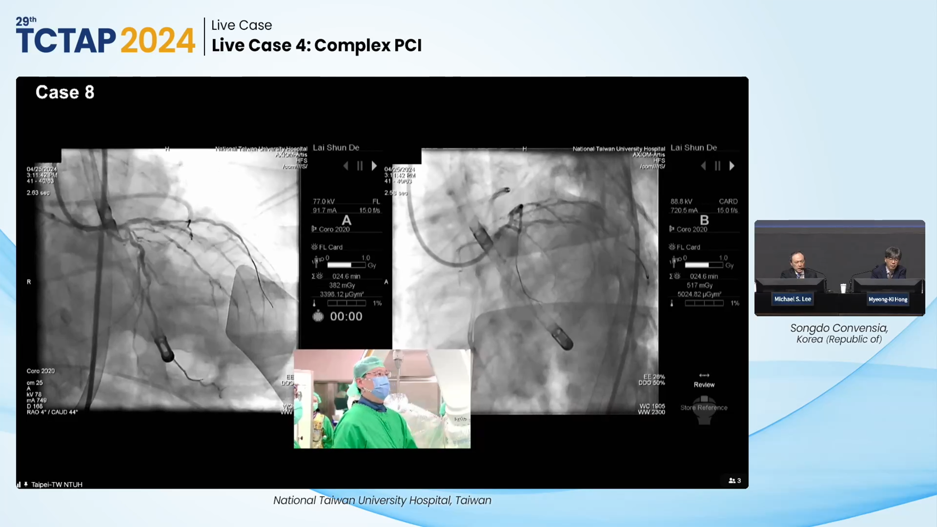 Live Case 4: Complex PCI