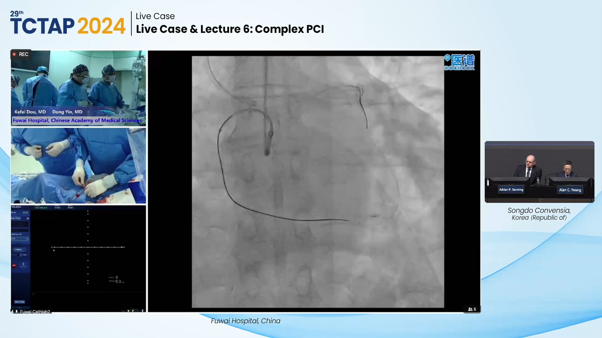 Live Case & Lecture 6: Complex PCI