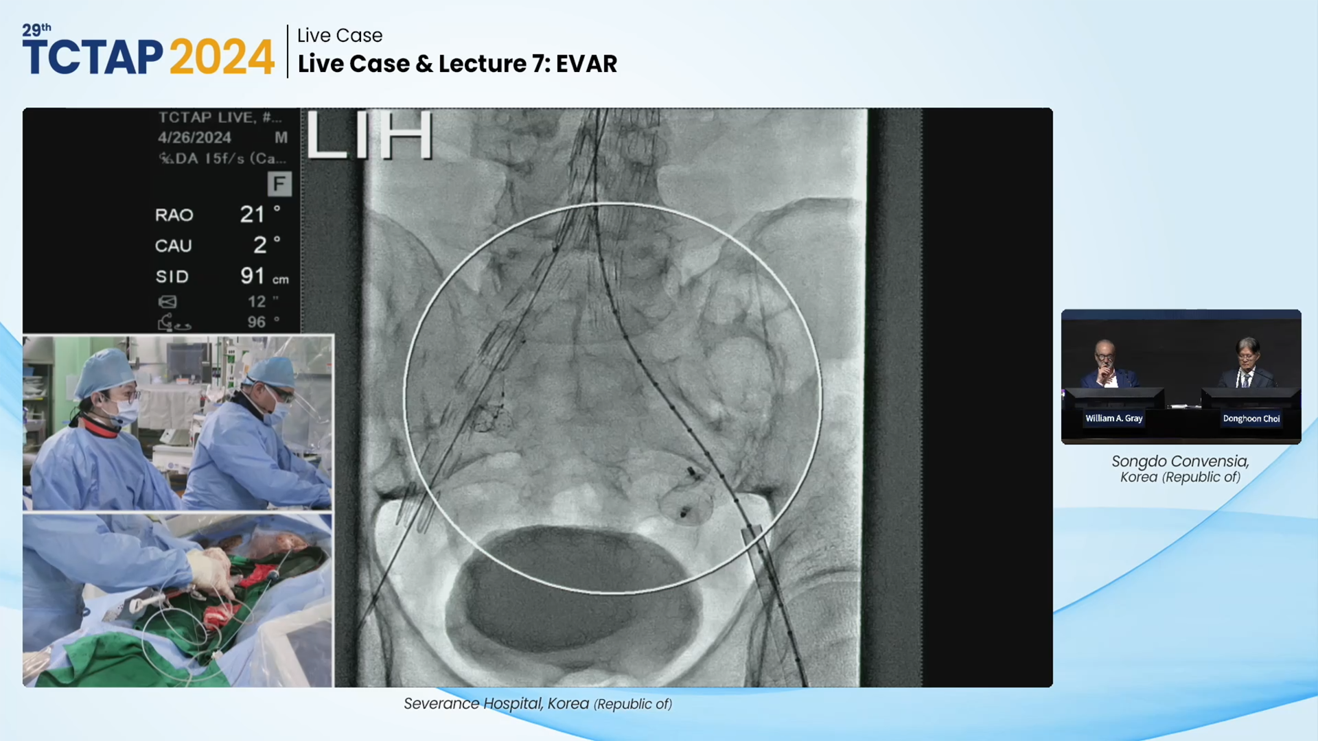 Live Case & Lecture 7: EVAR