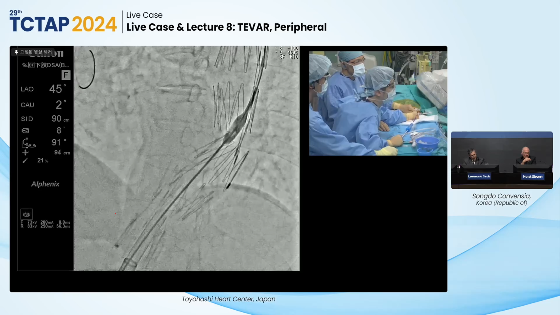 Live Case & Lecture 8: TEVAR, Peripheral