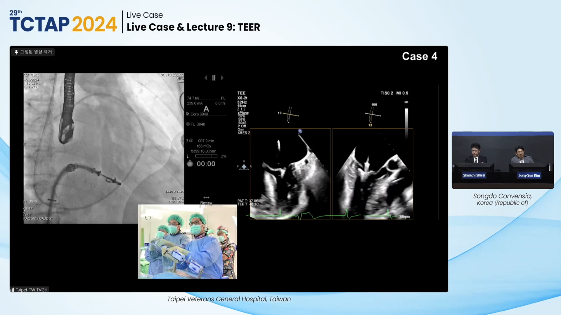 Live Case & Lecture 9: TEER