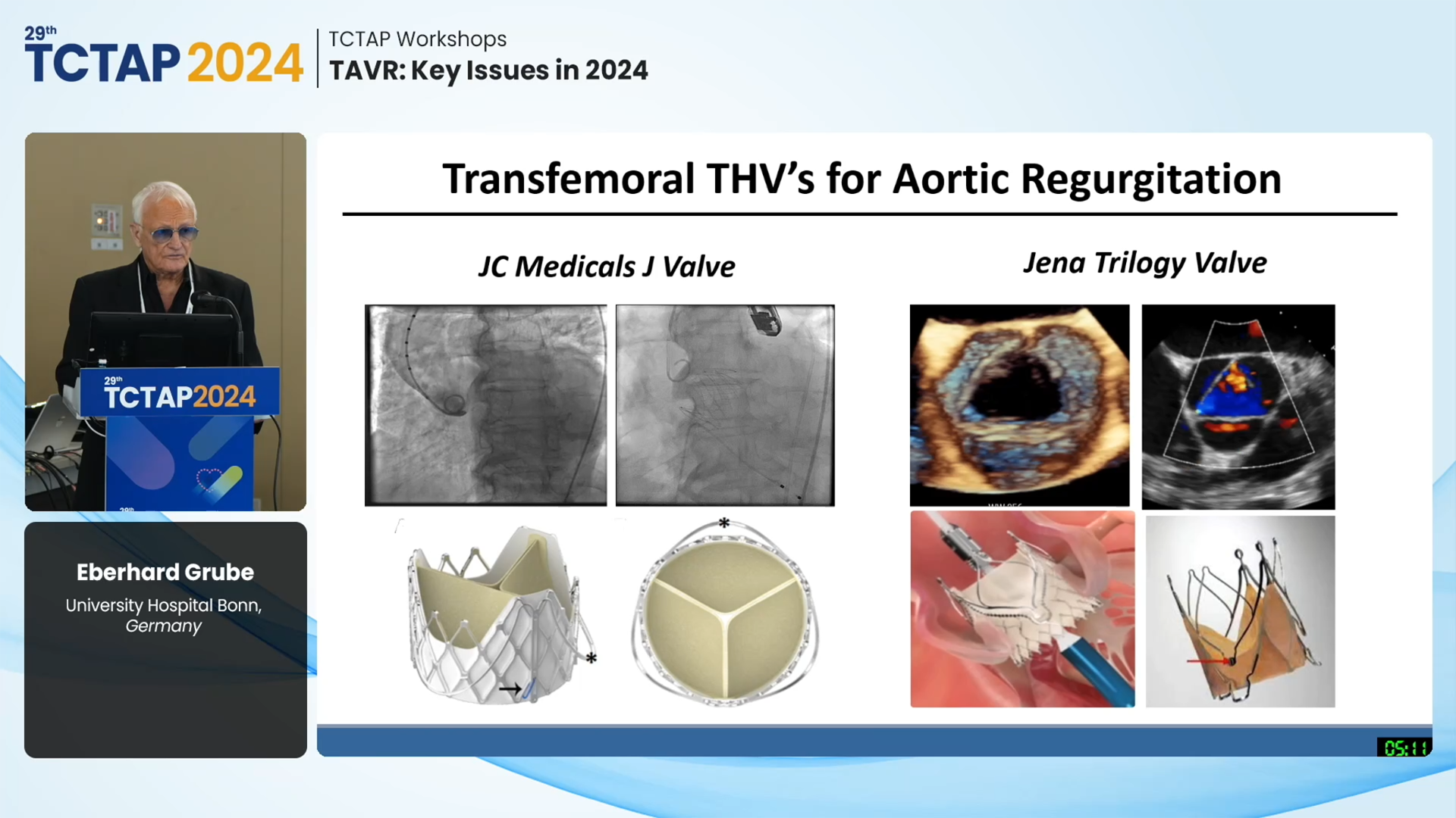 [TCTAP Workshops] TAVR: Key Issues in 2024
