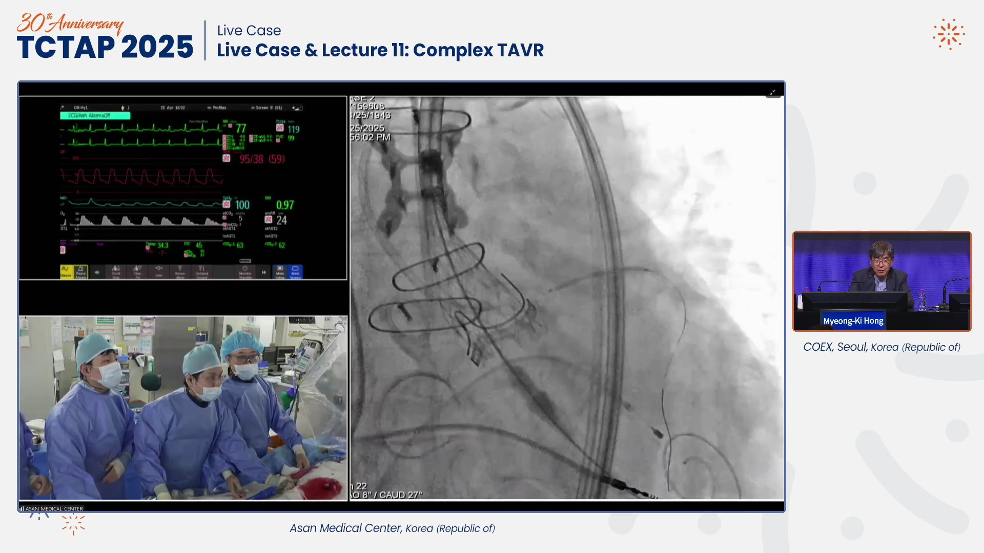 Live Case & Lecture 11: Complex TAVR