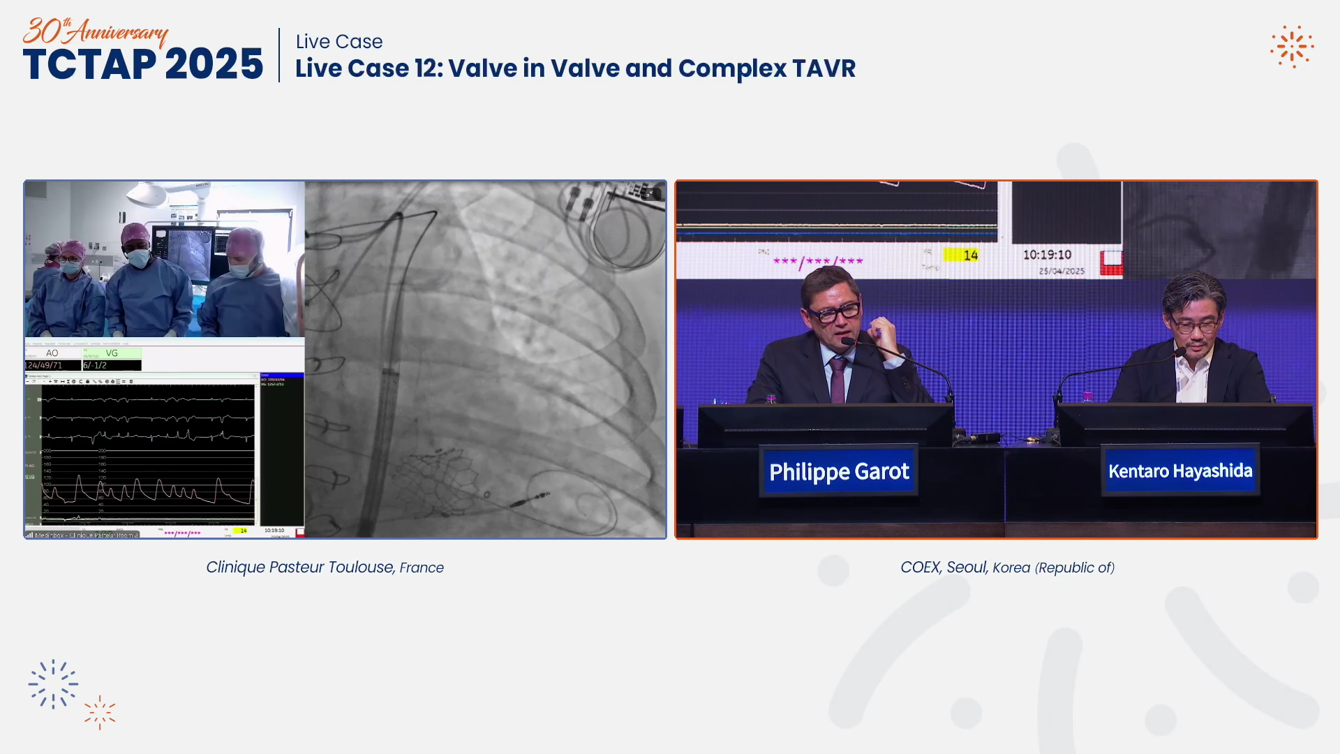Live Case 12: Valve in Valve and Complex TAVR