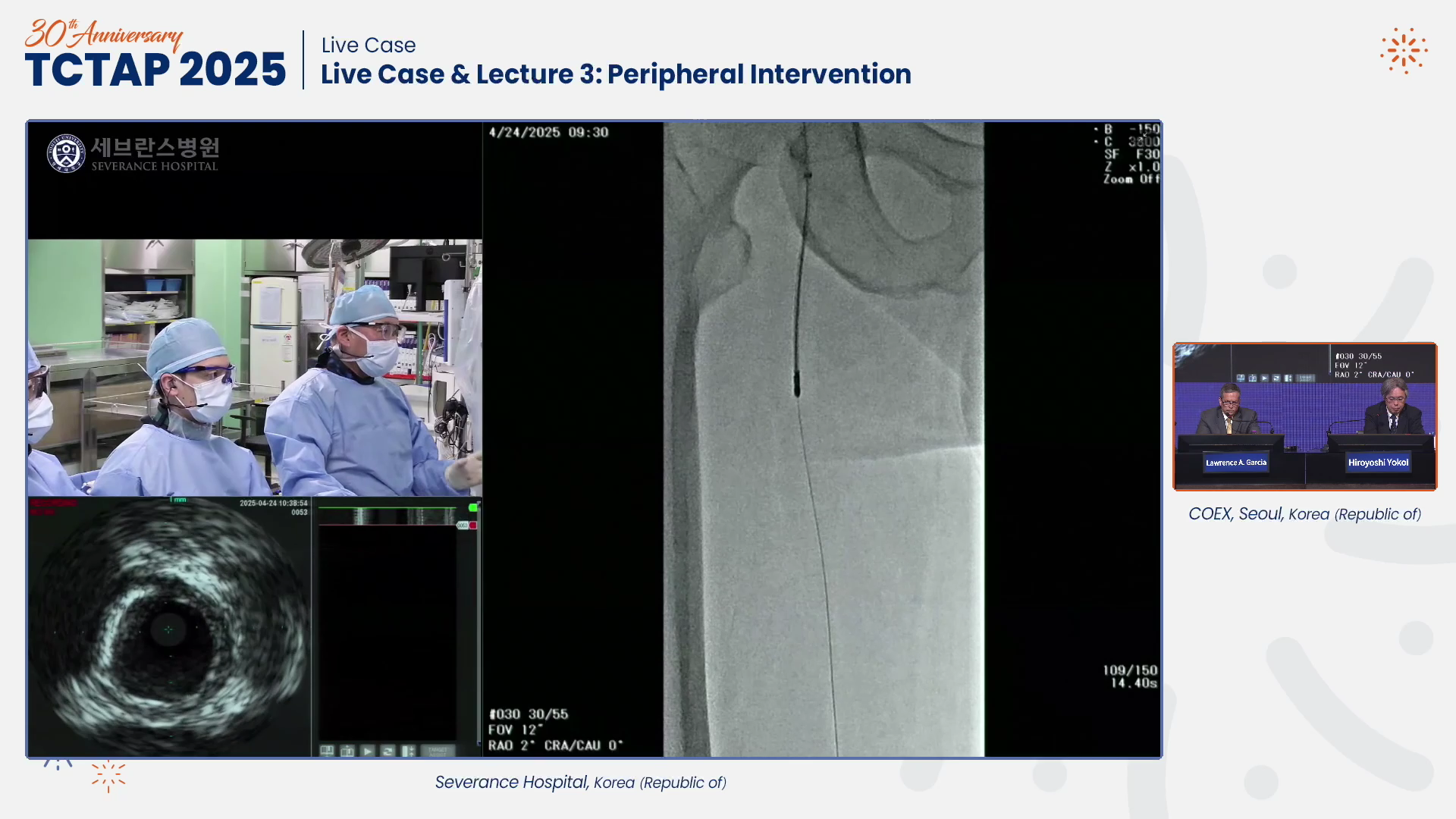 Live Case & Lecture 3: Peripheral Intervention