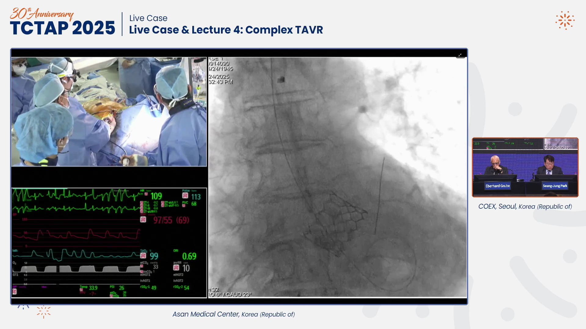 Live Case & Lecture 4: Complex TAVR