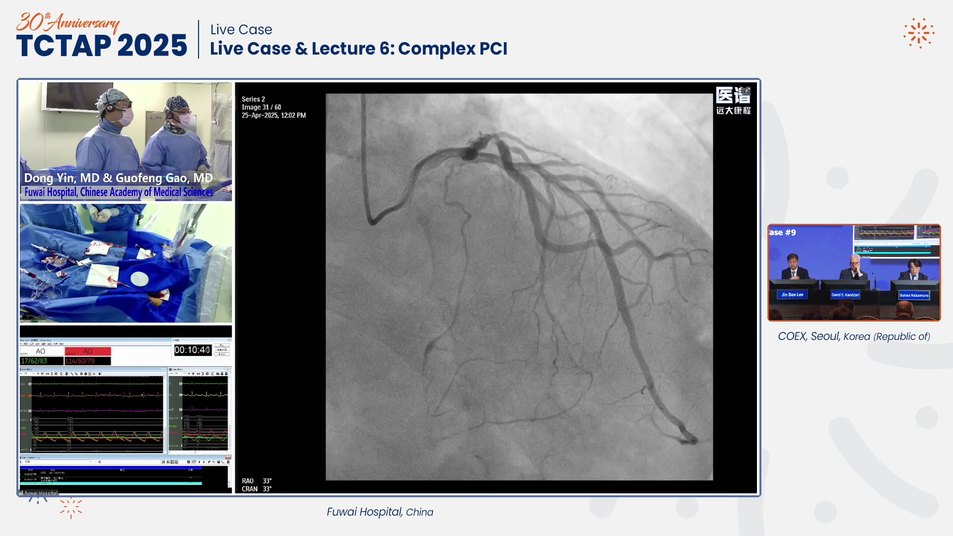 Live Case & Lecture 6: Complex PCI
