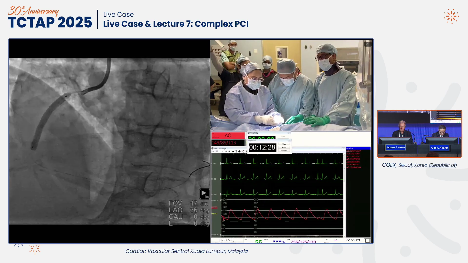 Live Case & Lecture 7: Complex PCI