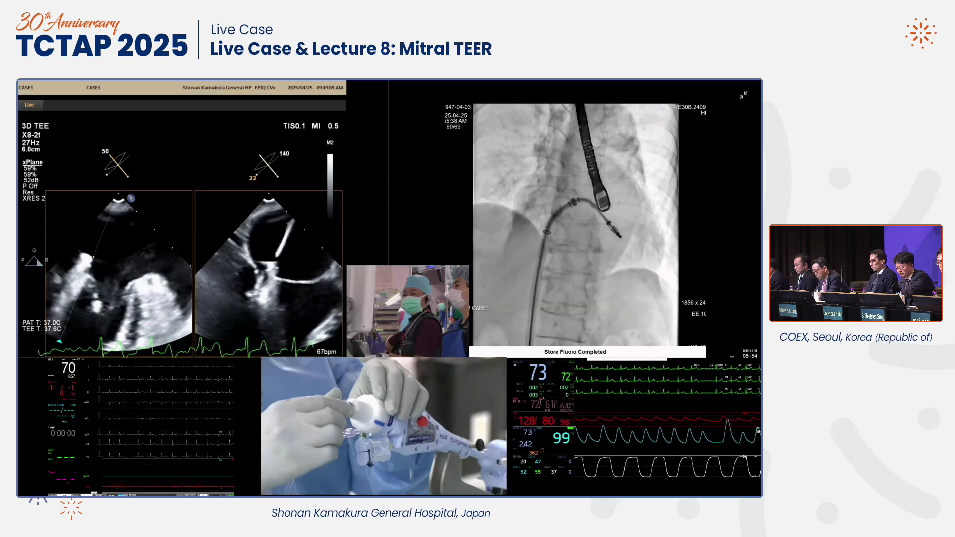 Live Case & Lecture 8: Mitral TEER