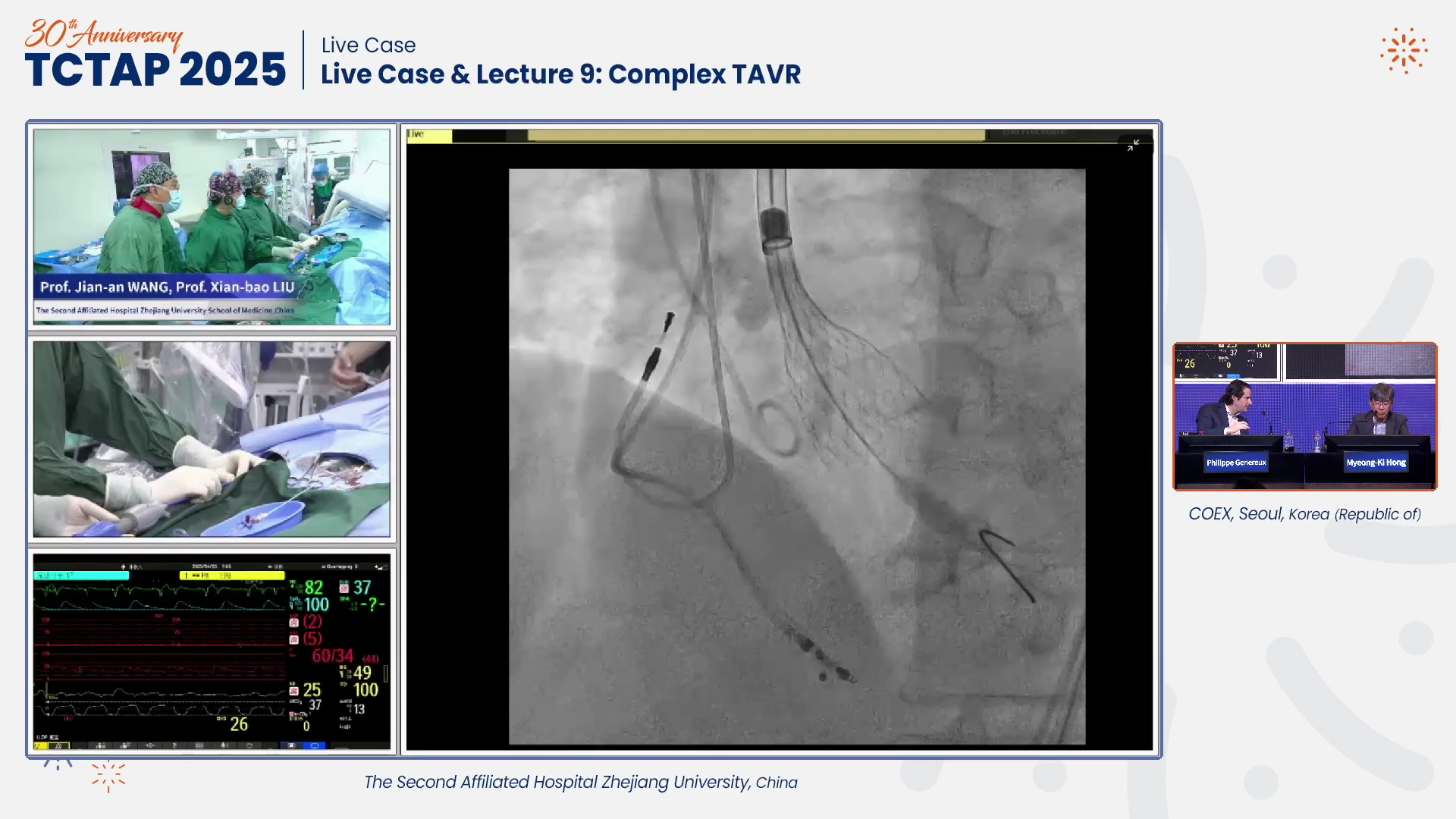 Live Case & Lecture 9: Complex TAVR