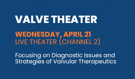 Valve Theater - Wednesday, April 21 / Live Theater (Channel 2)